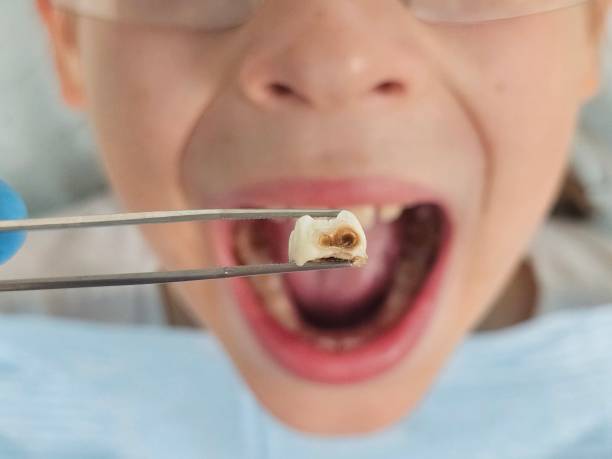 Best Weekend Emergency Dentist in Terrell, TX